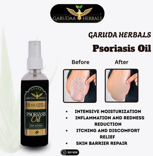 Garuda Herbal Psoriasis Oil